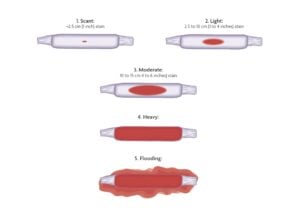 Lượng máu chảy tương tự mức 5, cần tới cơ sở y tế ngay lập tức