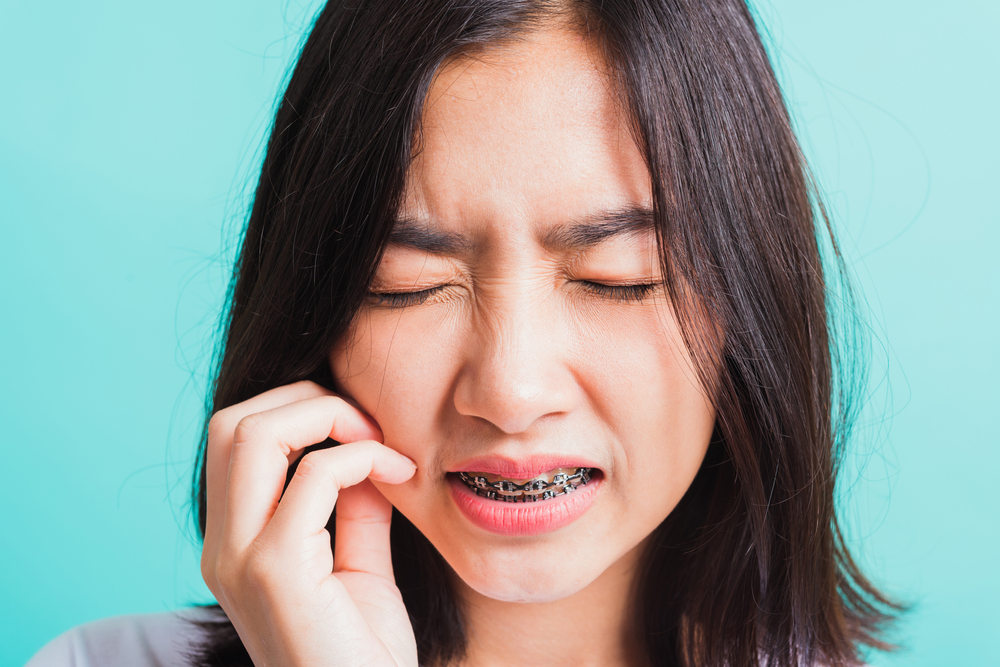 Niềng răng khiến các vấn đề về nướu tồi tệ hơn