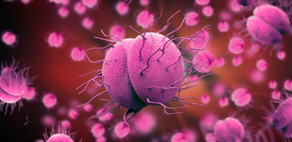 Bệnh lậu (Gonorrhea) là bệnh lây truyền qua đường tình dục do nhiễm vi khuẩn lậu cầu - neisseria gonorrhoeae.