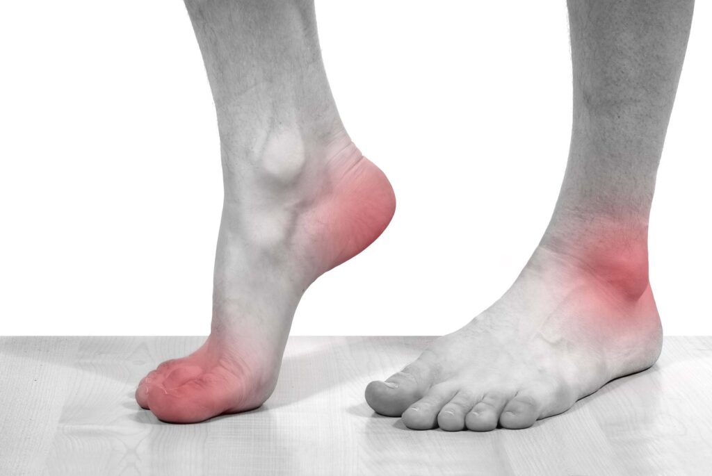 Lá cây địa lan vòi có công dụng trị gout hiệu quả 