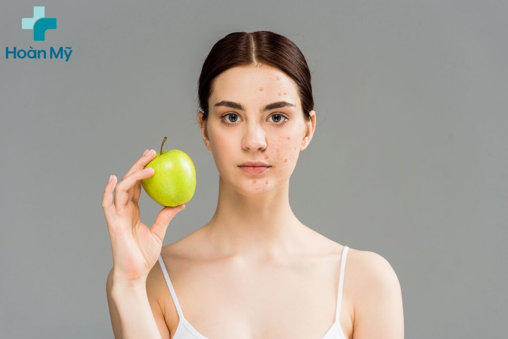 Duy trì làn da trẻ khỏe nhờ thói quen ăn táo mỗi ngày