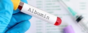 albumin