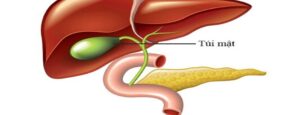 Polyp túi mật