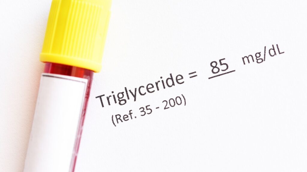 chỉ số triglyceride là gì?