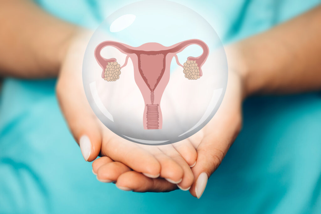 Hội chứng tăng sinh buồng trứng có thể gây ra biến chứng nghiêm trọng 