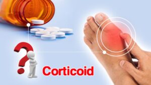 Cần tìm hiểu kỹ trước khi sử dụng corticoid để đảm bảo an toàn