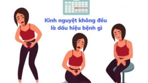 Kinh nguyệt không đều là chu kỳ bị rối loạn