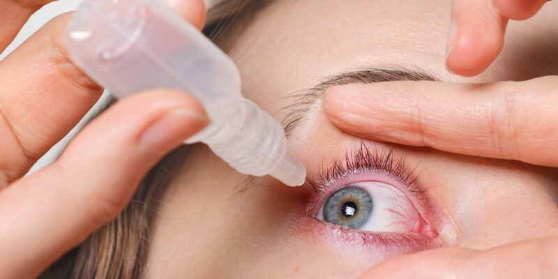 Tìm hiểu và áp dụng các cách điều trị đau mắt đỏ hiệu quả