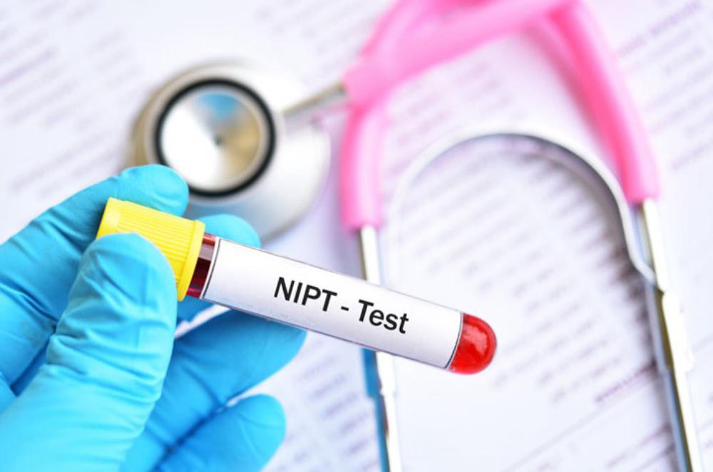 NIPT là một phương pháp xét nghiệm an toàn