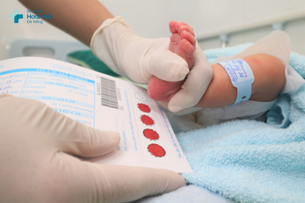 Lấy máu gót chân sàng lọc 73 bệnh lý ở trẻ sơ sinh