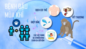 Bệnh đậu mùa khỉ là gì?