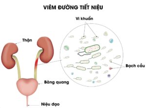 Biểu hiện taiij chỗ