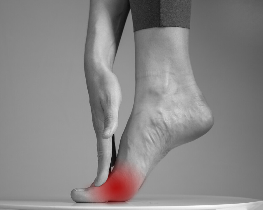 Đau xương bàn chân có thể được gây ra bởi tình trạng thừa cân, béo phì hay hoạt động thể thao với cường độ mạnh.