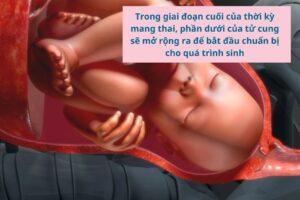 Cổ tử cung giãn nở