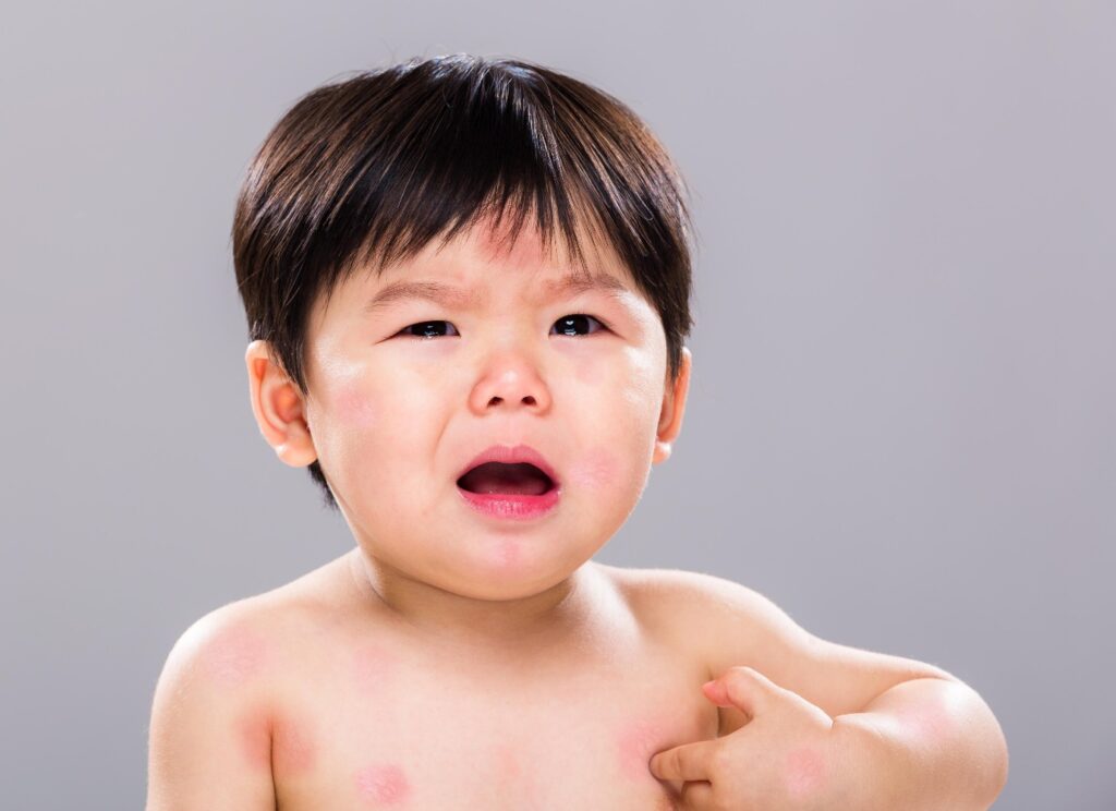 Lạm dụng hạ sốt có thể làm trẻ em kích ứng 