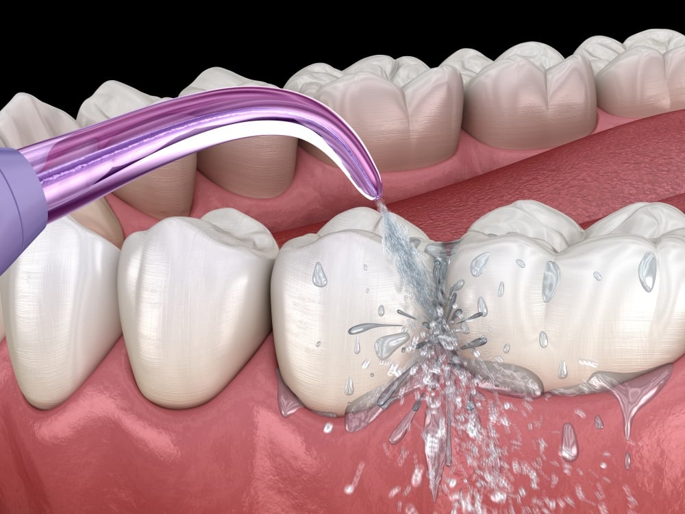 Tăm nước là thiết bị có thể dễ dàng sử dụng