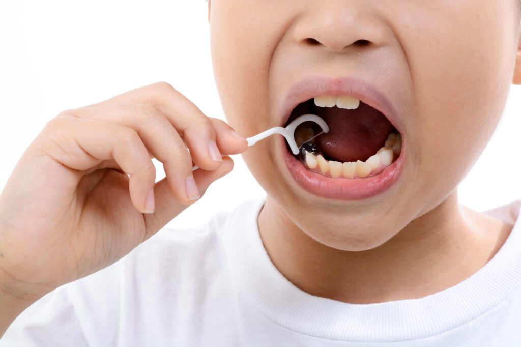 Trẻ em có thể dùng chỉ để làm sạch răng 