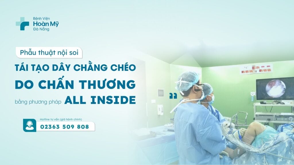 Phẫu thuật nội soi tái tạo dây chằng chéo do chấn thương bằng phương pháp All Inside