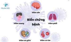 Biến chứng bệnh cúm a