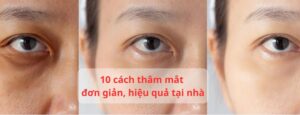 cách trị thâm mắt