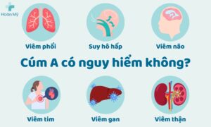 Cúm A có nguy hiển không?