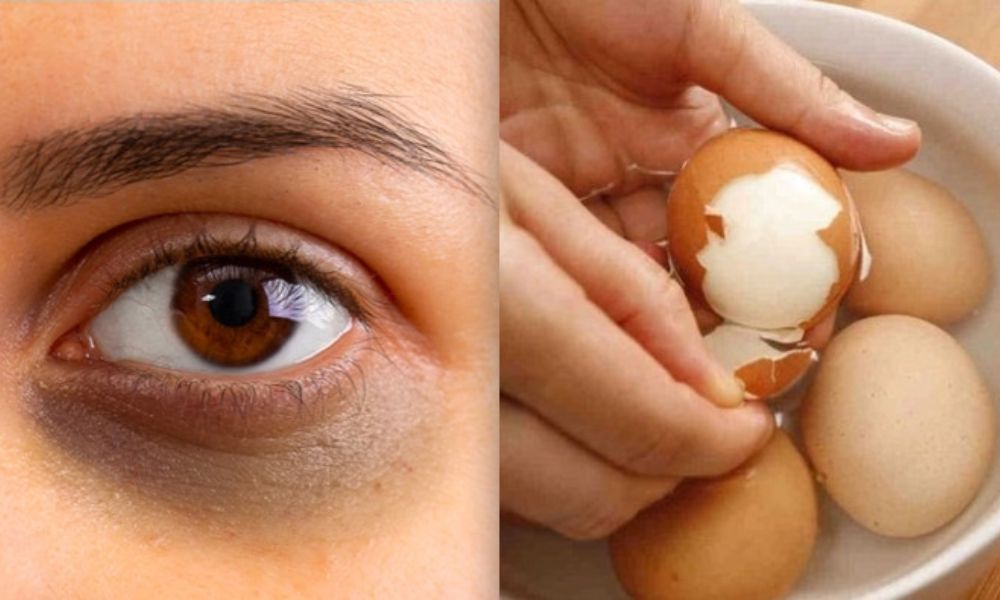 Lăn trứng luộc giúp giảm quầng thâm mắt hiệu quả 