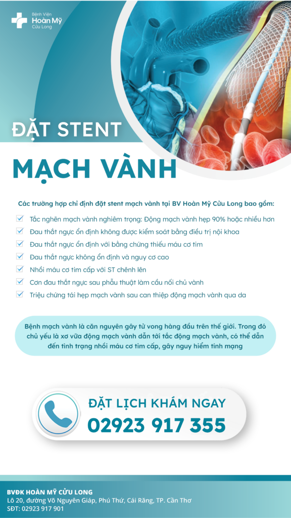 Chụp và đặt stent điều trị bệnh lý mạch vành