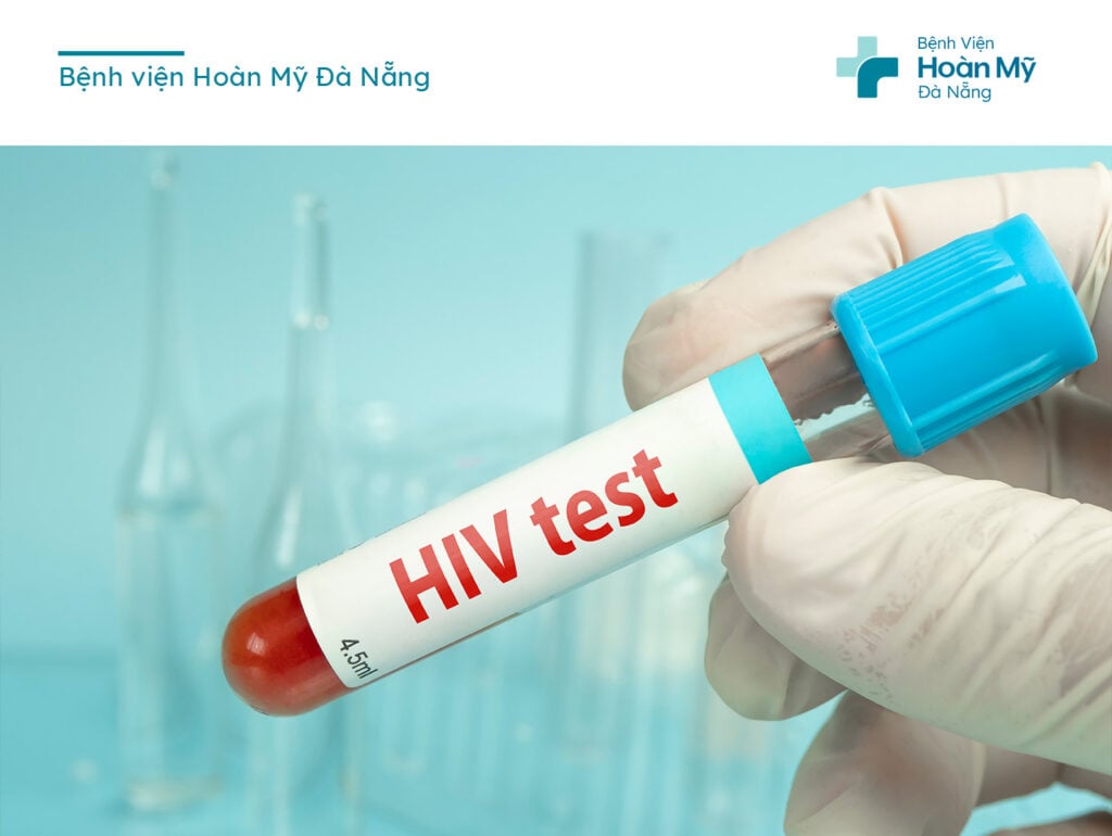 Xét nghiệm HIV cho mẹ sức khỏe cho con