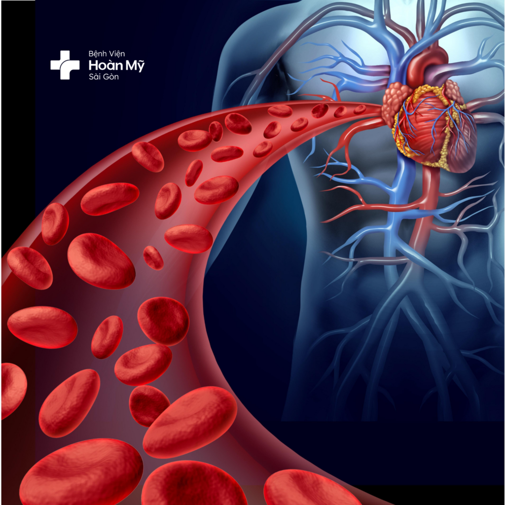 Rối loạn chuyển hóa lipid máu dễ dẫn đến các biến chứng về tim mạch