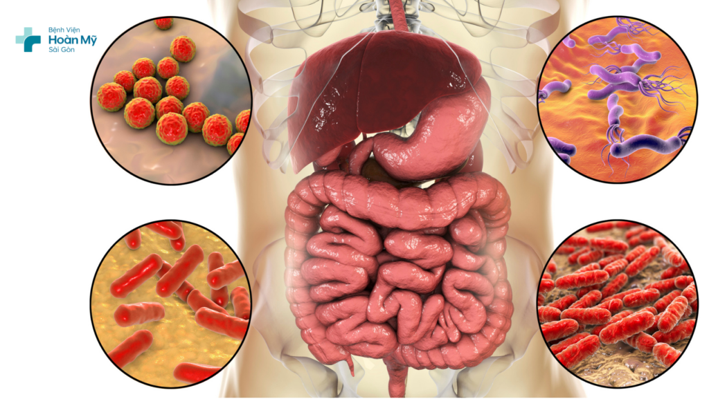 Vi khuẩn, virus là nguyên nhân chính gây nên viêm ruột cấp tính