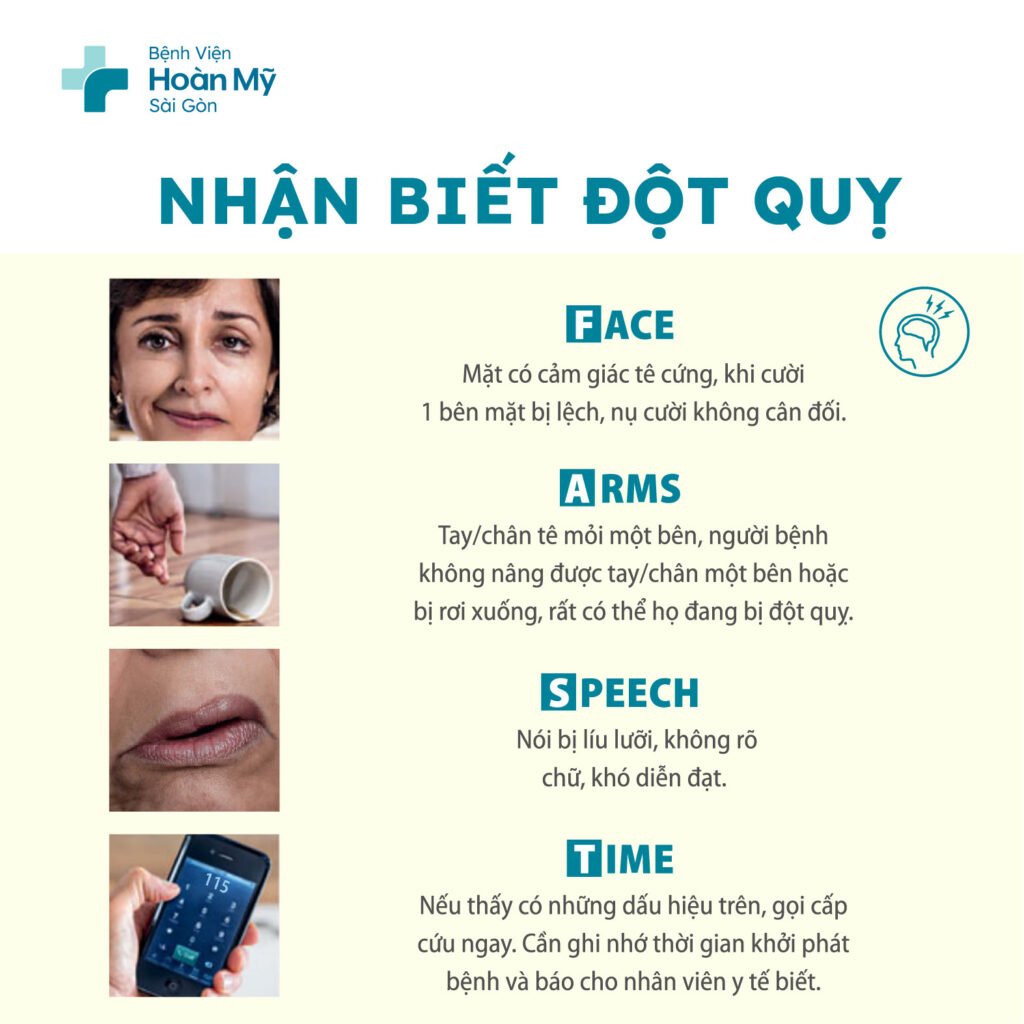 Nhận biết các dấu hiệu, triệu chứng đột quỵ