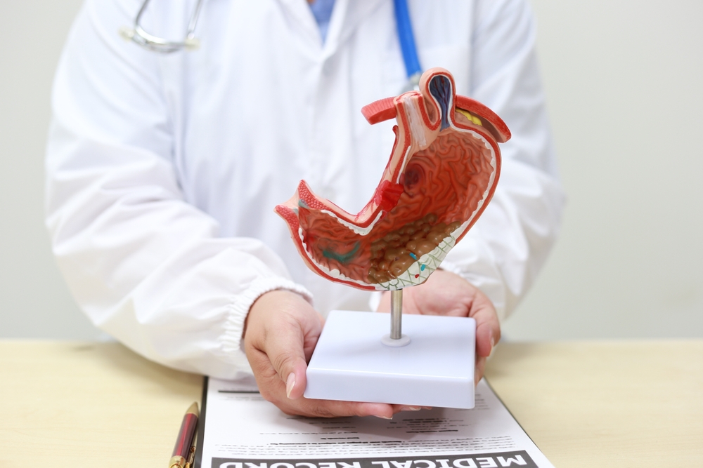  Gastrointestinal Surgery