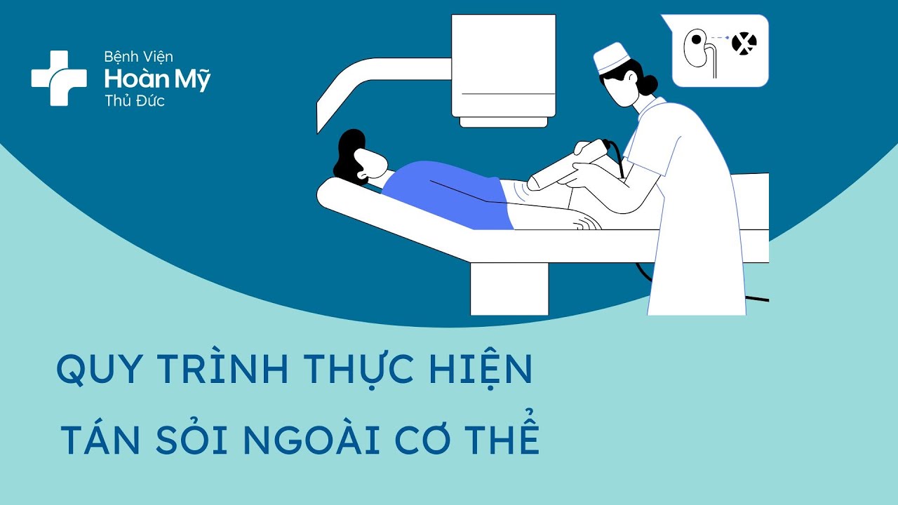Extracorporeal lithotripsy procedure | Hoan My Thu Duc Hospital