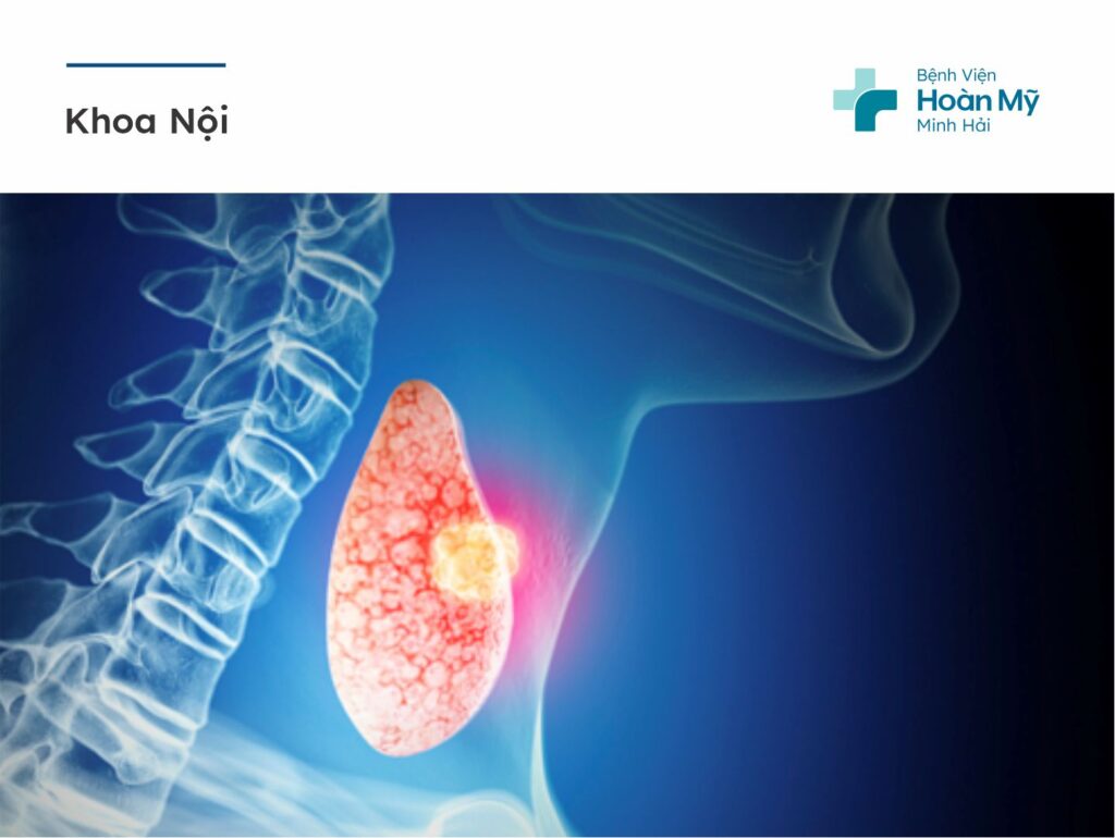 Bệnh lý tuyến giáp và những điều cần biết