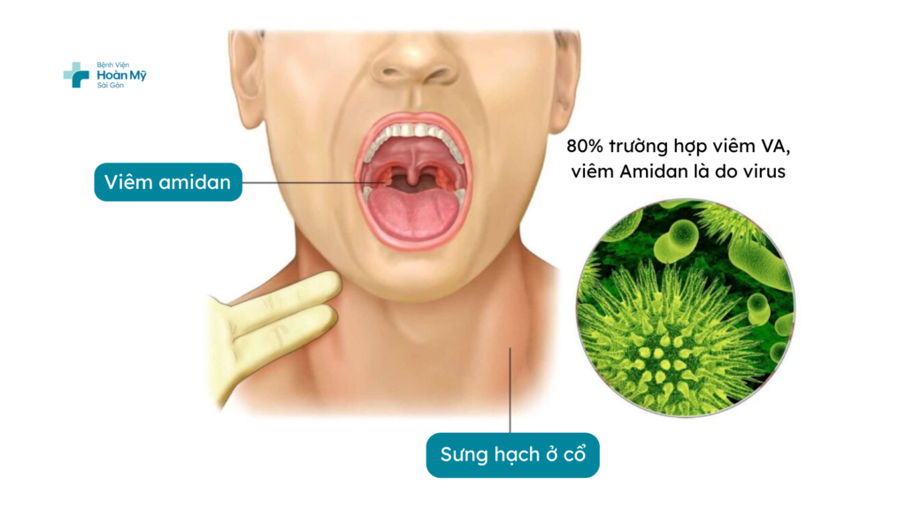 Khi nào nên cắt amidan và nạo VA cho trẻ lứa tuổi học đường?