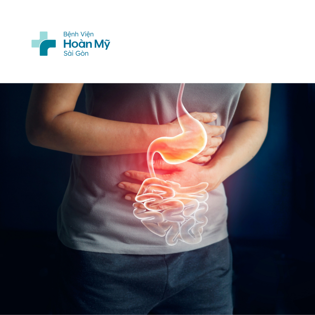 Nội soi dạ dày là phương pháp tầm soát tốt nhất để phát hiện sớm ung thư dạ dày