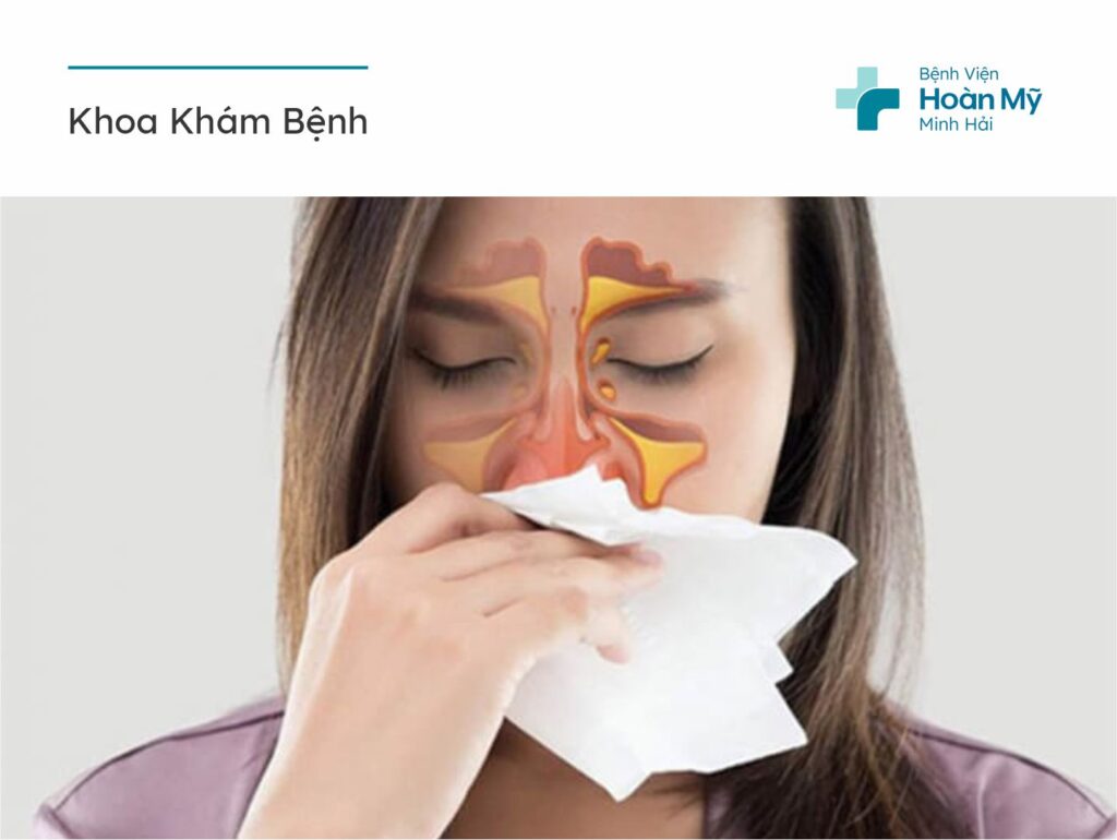 Tìm hiểu về bệnh viêm xoang