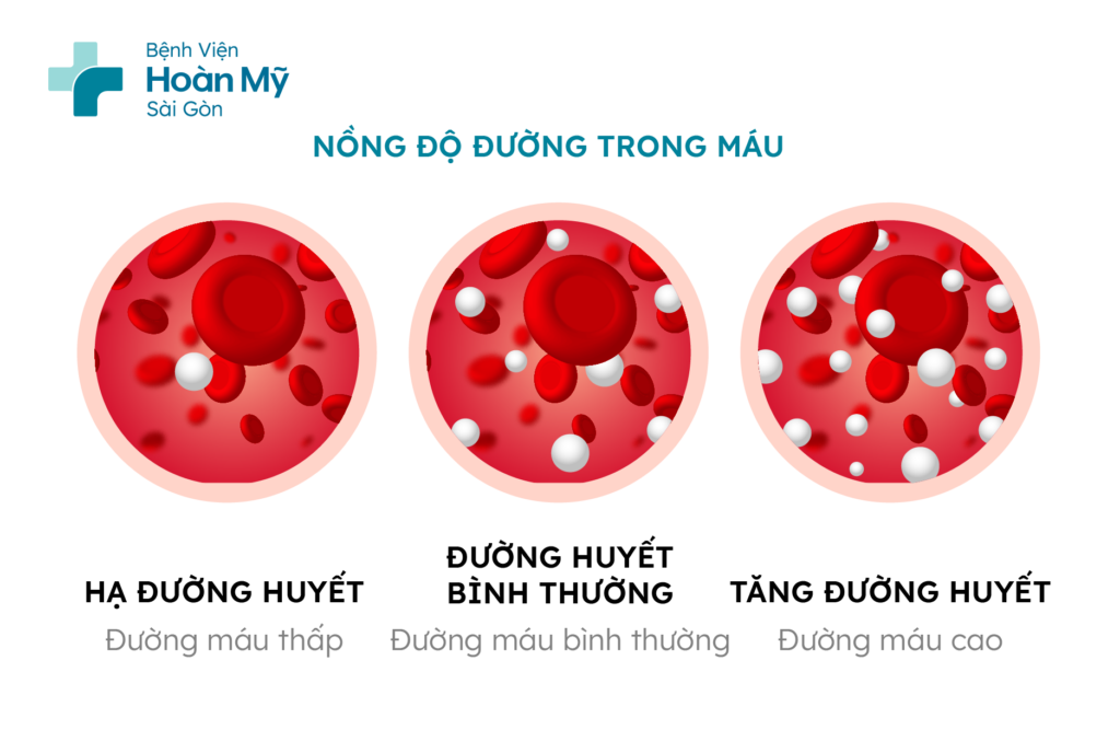 Hạ đường huyết có nguy hiểm không? Nguyên nhân và cách xử trí