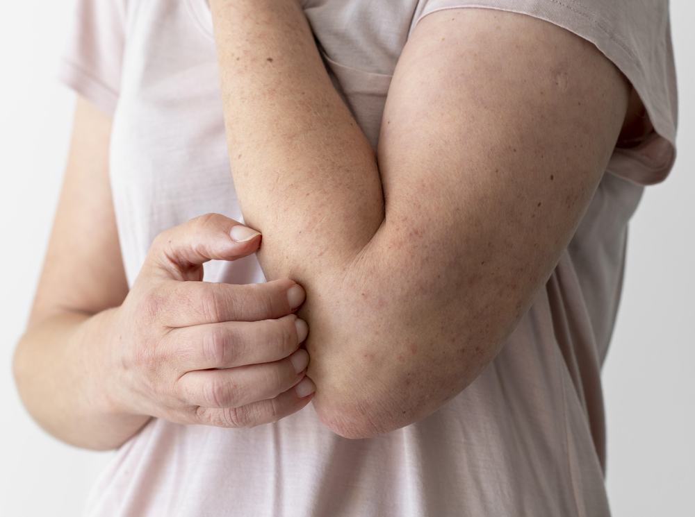 Một số lưu ý khi dùng thuốc Acetaminophen