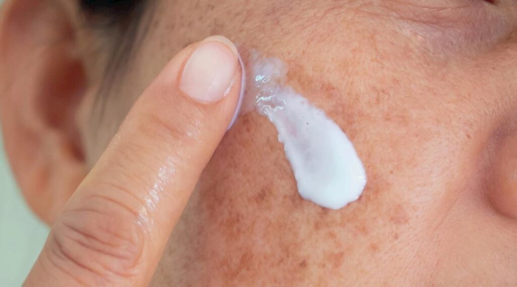 Azelaic acid có tác dụng gì?