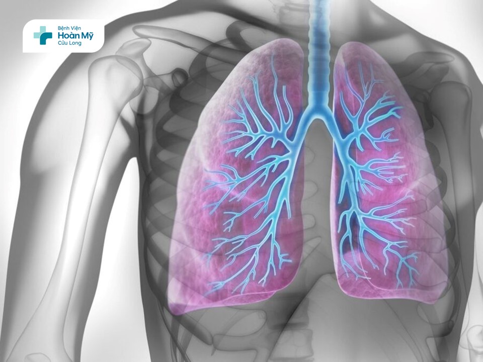 Những điều cần biết về suy hô hấp cấp