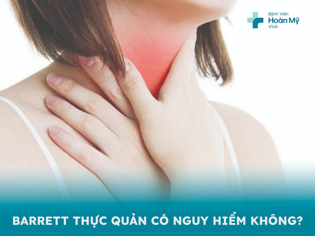Barrett thực quản là bệnh gì và có nguy hiểm không?