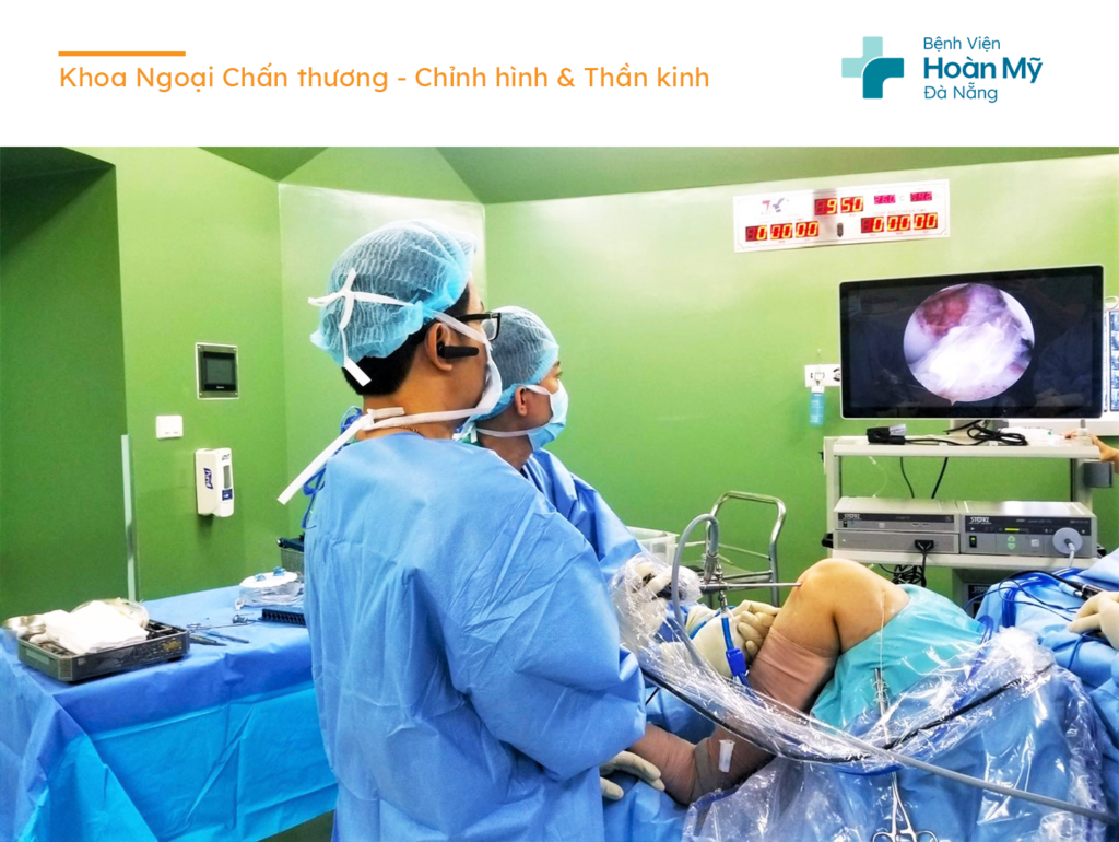 Phẫu thuật tái tạo dây chằng chéo khớp gối cho người bệnh qua nội soi