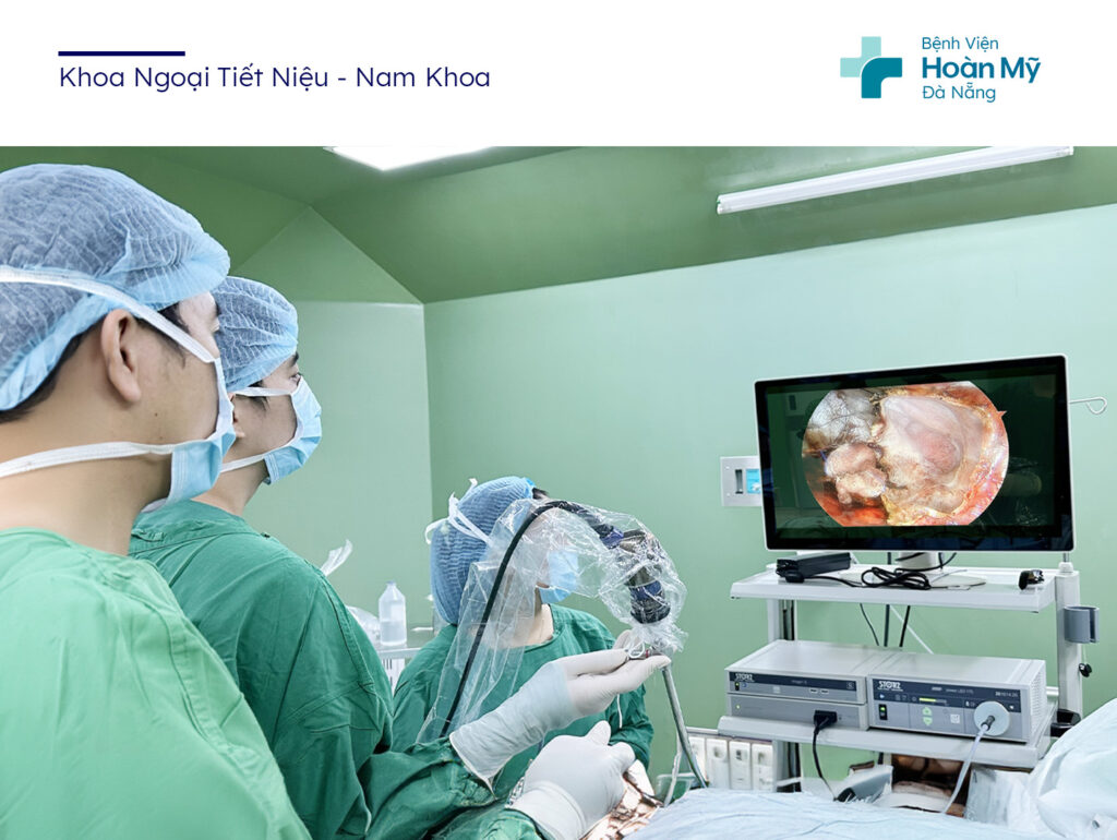 Điều trị nang thận kích thước lớn bằng phẫu thuật nội soi ít xâm lấn, thẩm mỹ