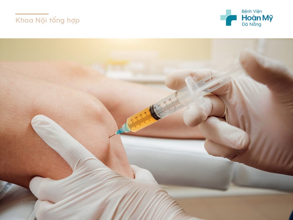 Chi tiết quy trình tiêm huyết tương giàu tiểu cầu khớp gối và mô quanh gân tại Bệnh viện Hoàn Mỹ Đà Nẵng