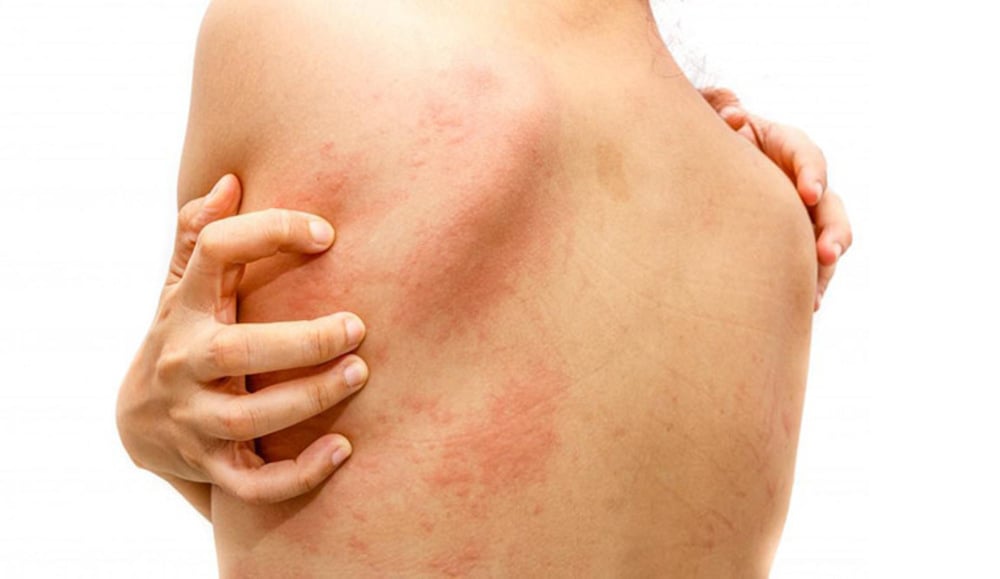 Tác dụng phụ của thuốc Magnesium