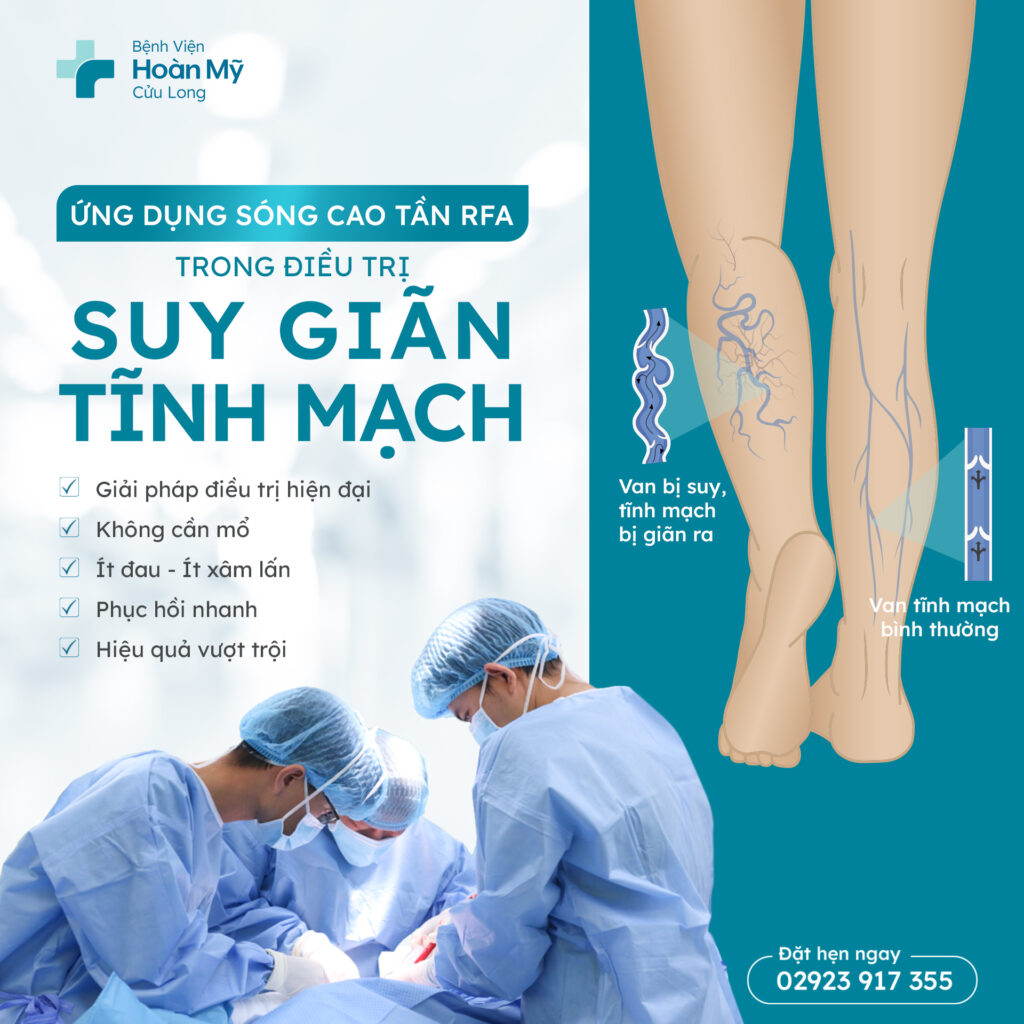Bệnh viện Hoàn Mỹ Cửu Long ứng dụng sóng cao tần (RFA) trong điều trị suy giãn tĩnh mạch