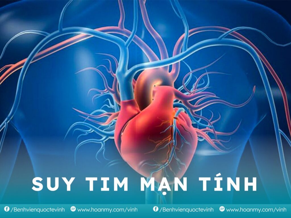 Suy tim mạn tính