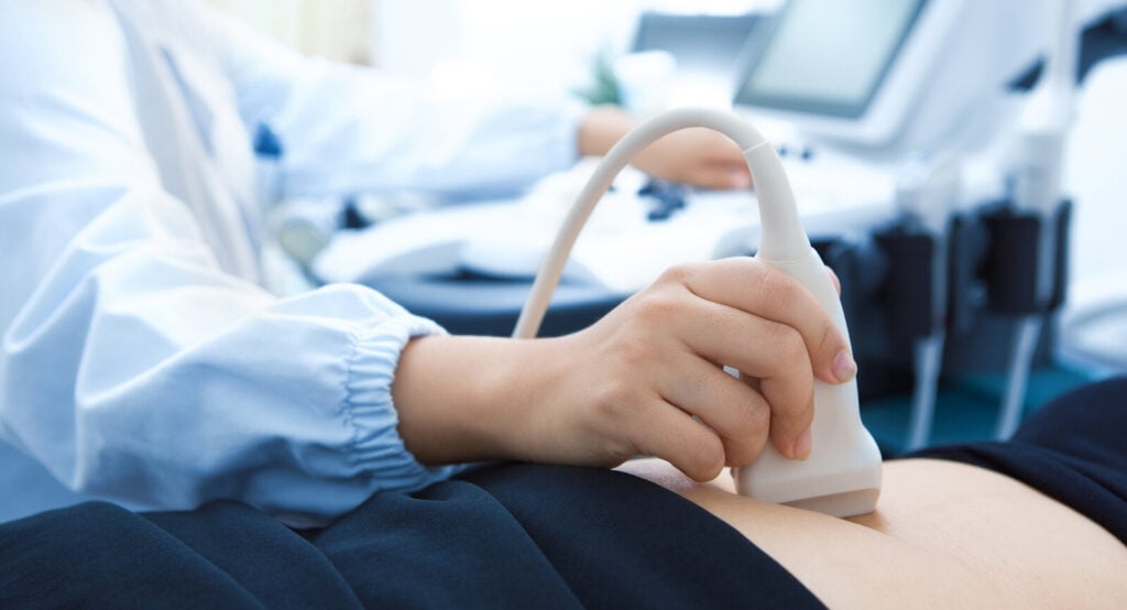 Siêu âm thai trong 3 tháng đầu để biết tuổi thai chính xác nhất 