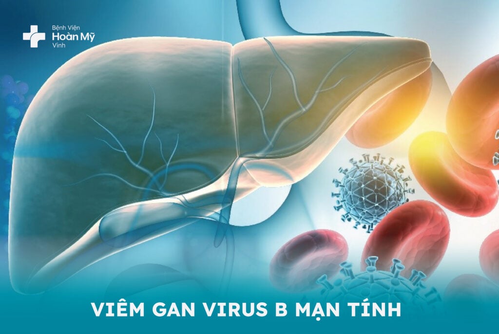 Viêm gan Virus B mạn tính – căn bệnh nguy hiểm có thể ngừa được bằng được bằng vaccine